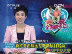 脊柱侧弯是怎么形成的