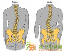 脊柱侧弯的多种病因