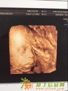 都市妇产四维彩超