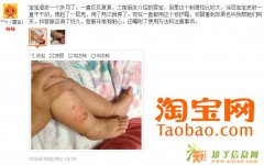 CJ思童舒敏多效修护霜无激素婴儿宝宝疹子发红湿痒蚊虫叮咬12