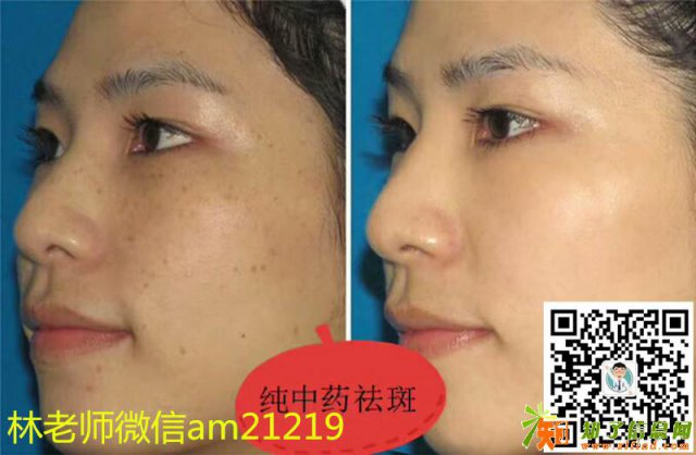 这4种方法让你快速美白祛斑不再是梦!