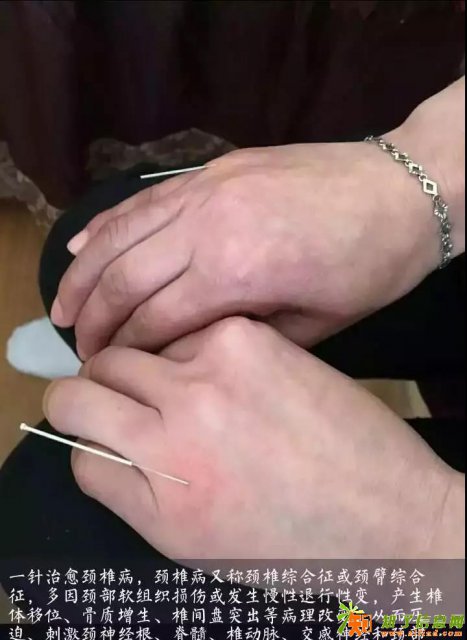 飞虎闪电针灸诊疗针法（减肥美容肿瘤偏瘫）高级班