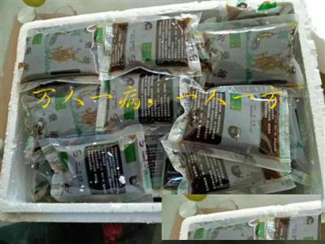 耳鸣耳鸣原因分析教你如何简单治耳鸣