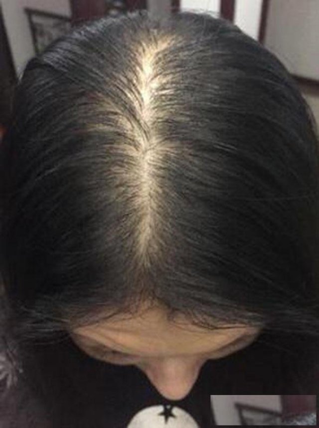 名益堂婷婷生发口碑评价