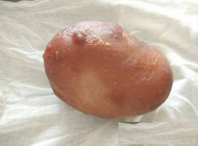 鸡宝能交易的地方