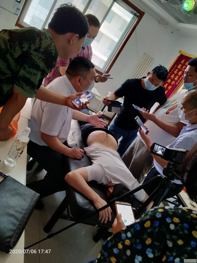 魏丕元肌筋膜松解术培训