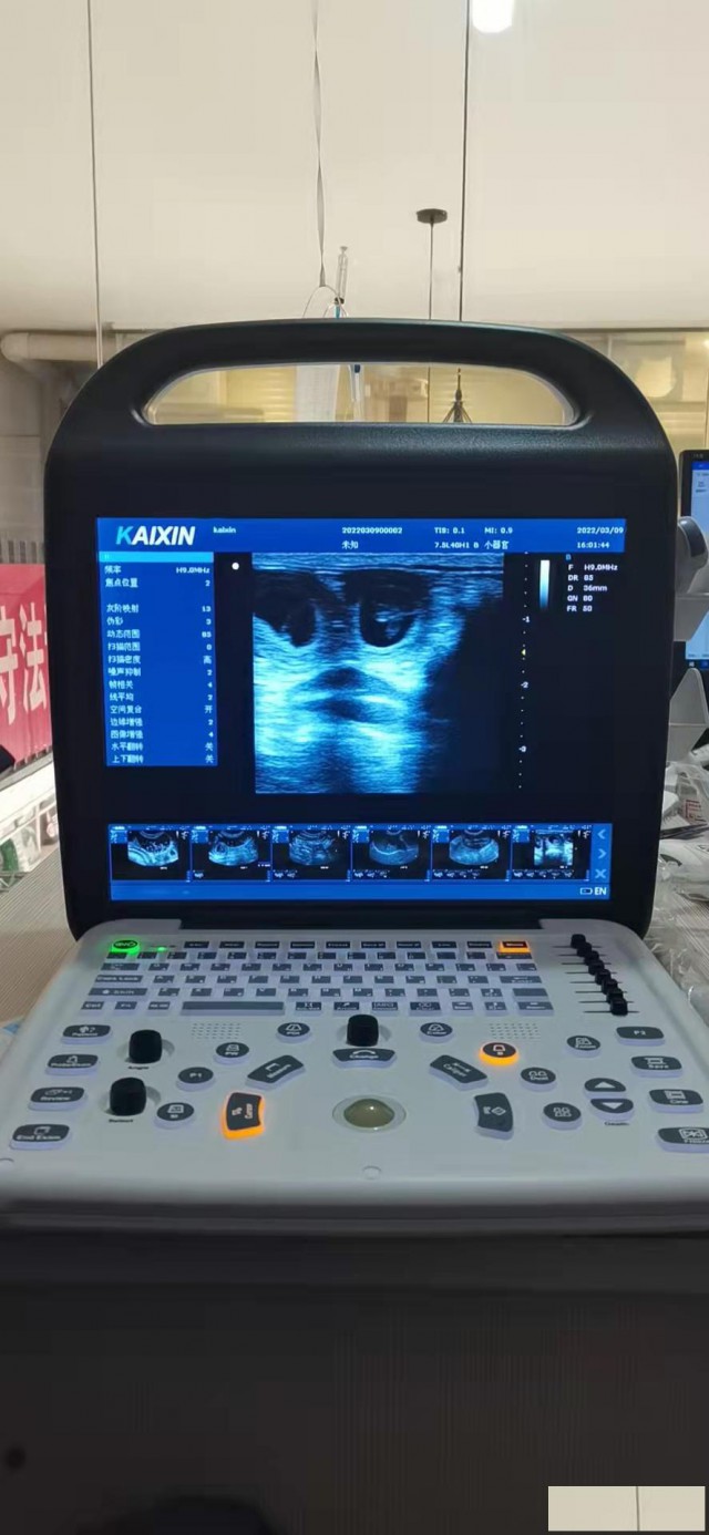 宠物医院彩超宠物狗孕检三胞胎