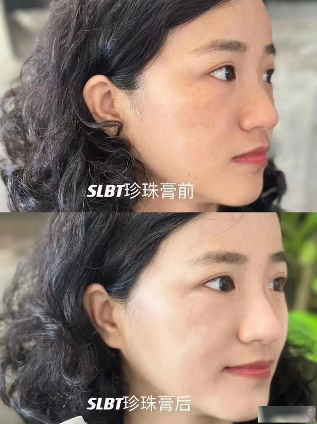 加盟代理施洛贝缇珍珠膏