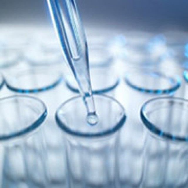 装修后测甲醛重视甲醛检测