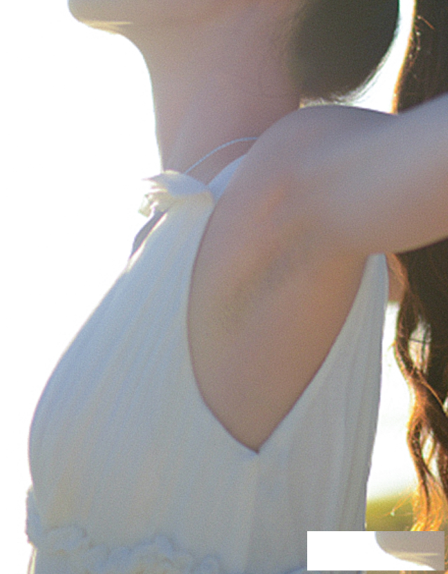 冷冻法祛狐臭好用吗有效果吗