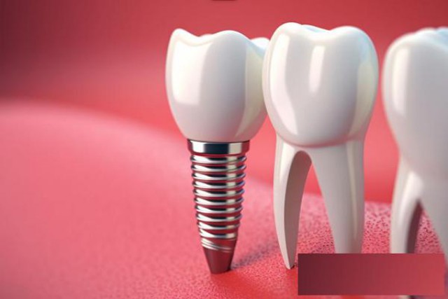 长沙雅贝康口腔种植牙医院