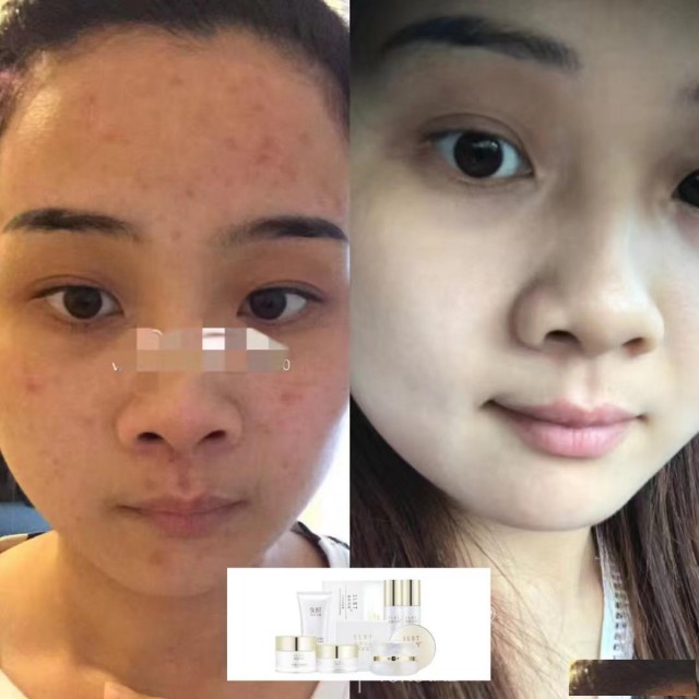 2024年为什么安利你使用施洛贝缇珍珠膏