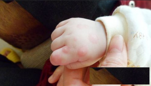 伟而特红外供暖：守护家庭健康，高效灭足口病病毒